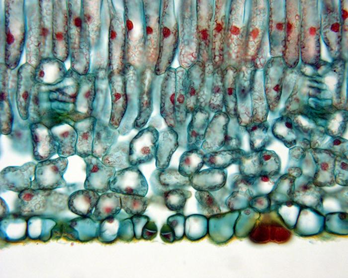 Cross section of lilac leaf