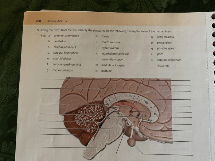 Exercise 17 gross anatomy of the brain and cranial nerves